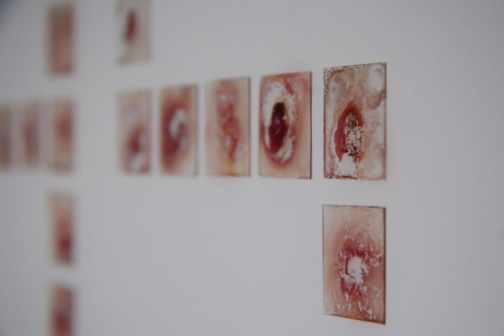my-blood-detail